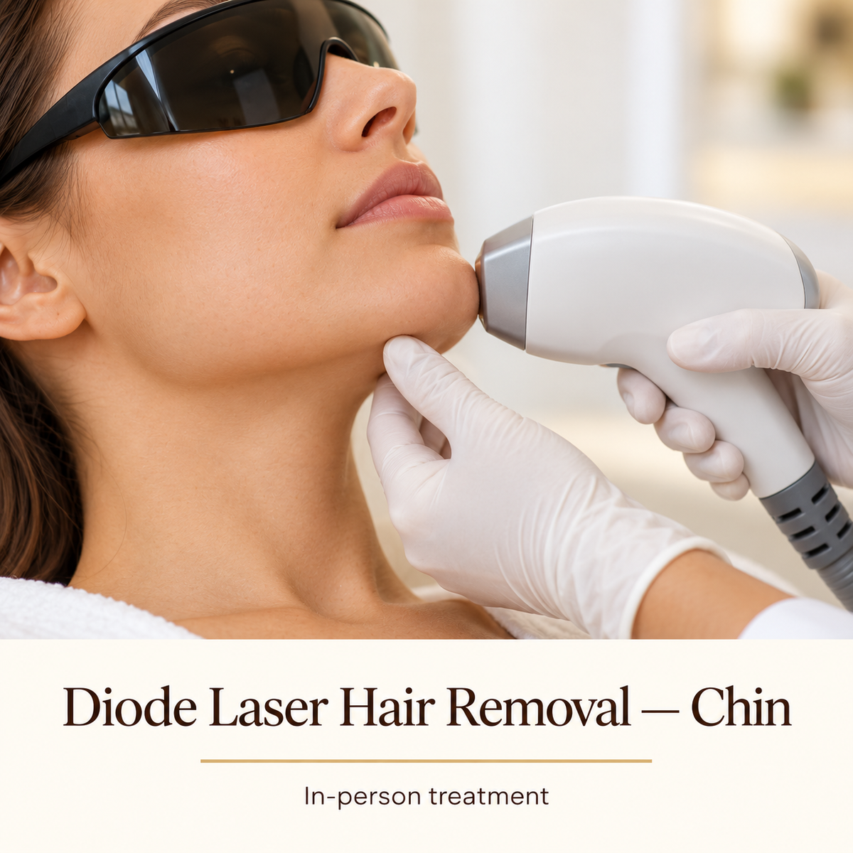 Illustrative Diode Laser Hair Removal — Chin — in-person treatment