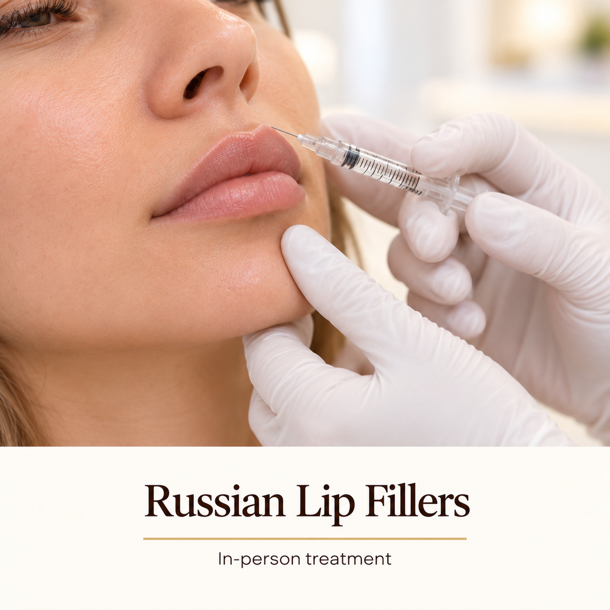 Russian Lip Fillers — in-person treatment