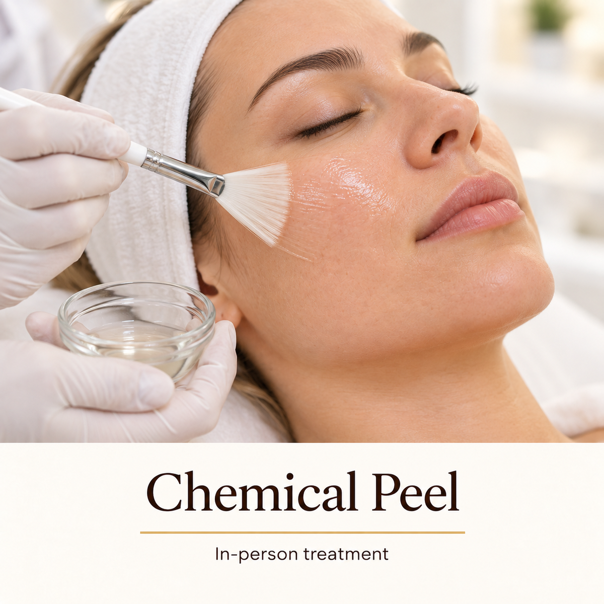Chemical Peel — in-person treatment