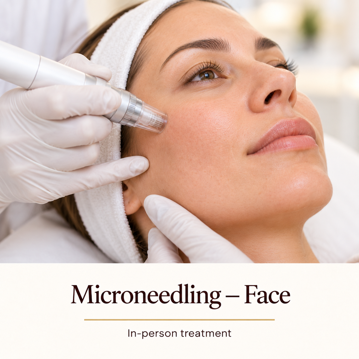 Microneedling — Face — in-person treatment