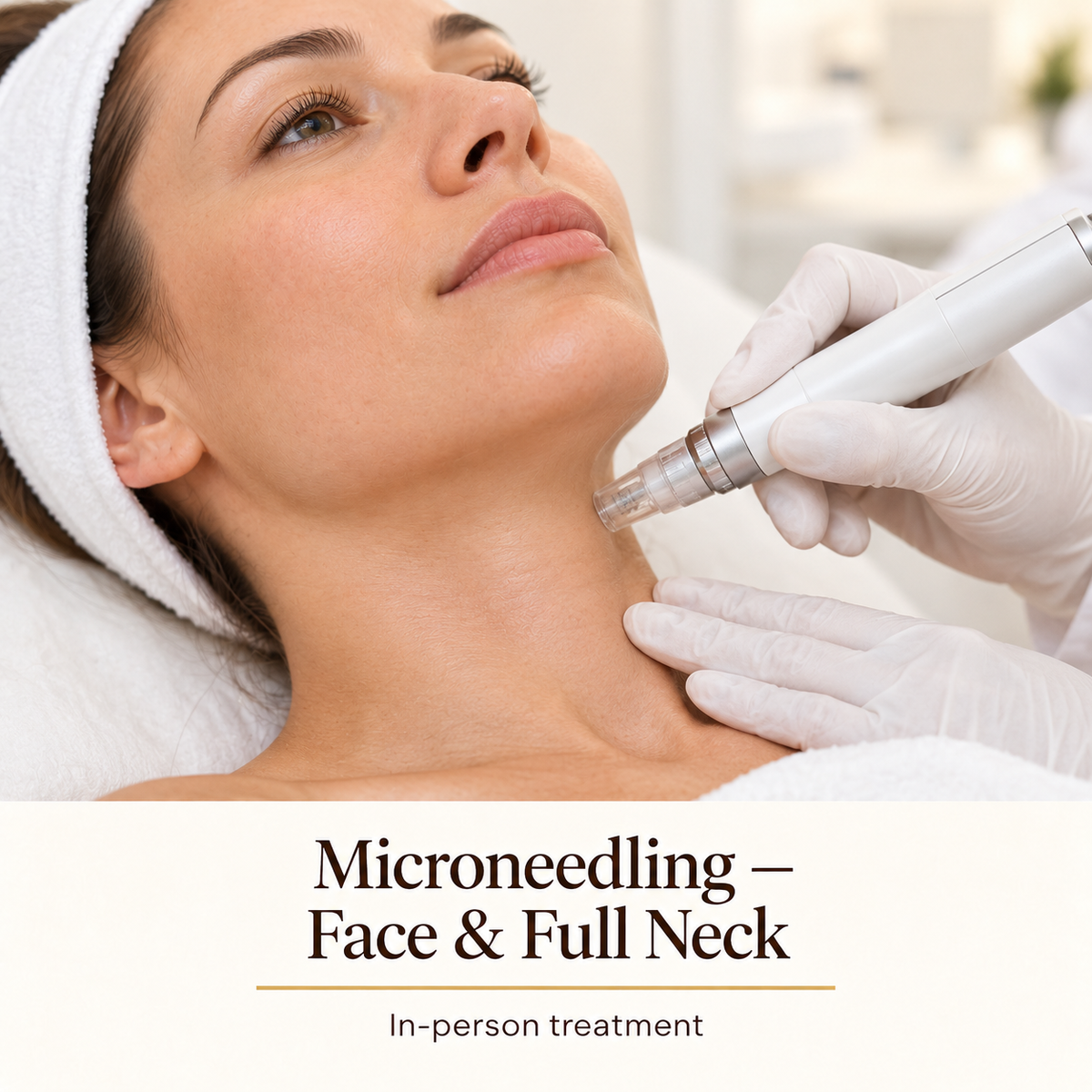 Microneedling — Face & Full Neck — in-person treatment